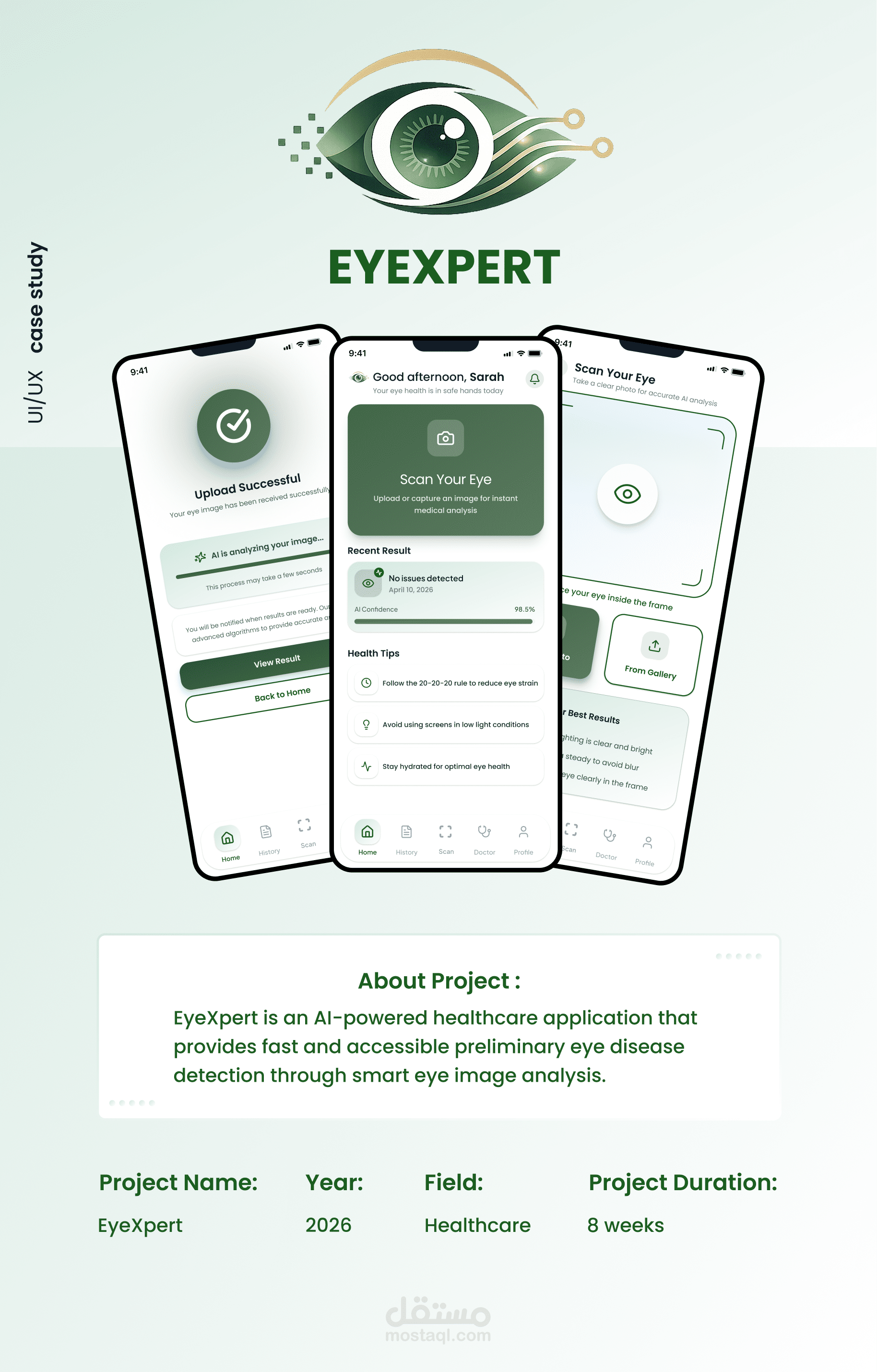 EYEXPERT