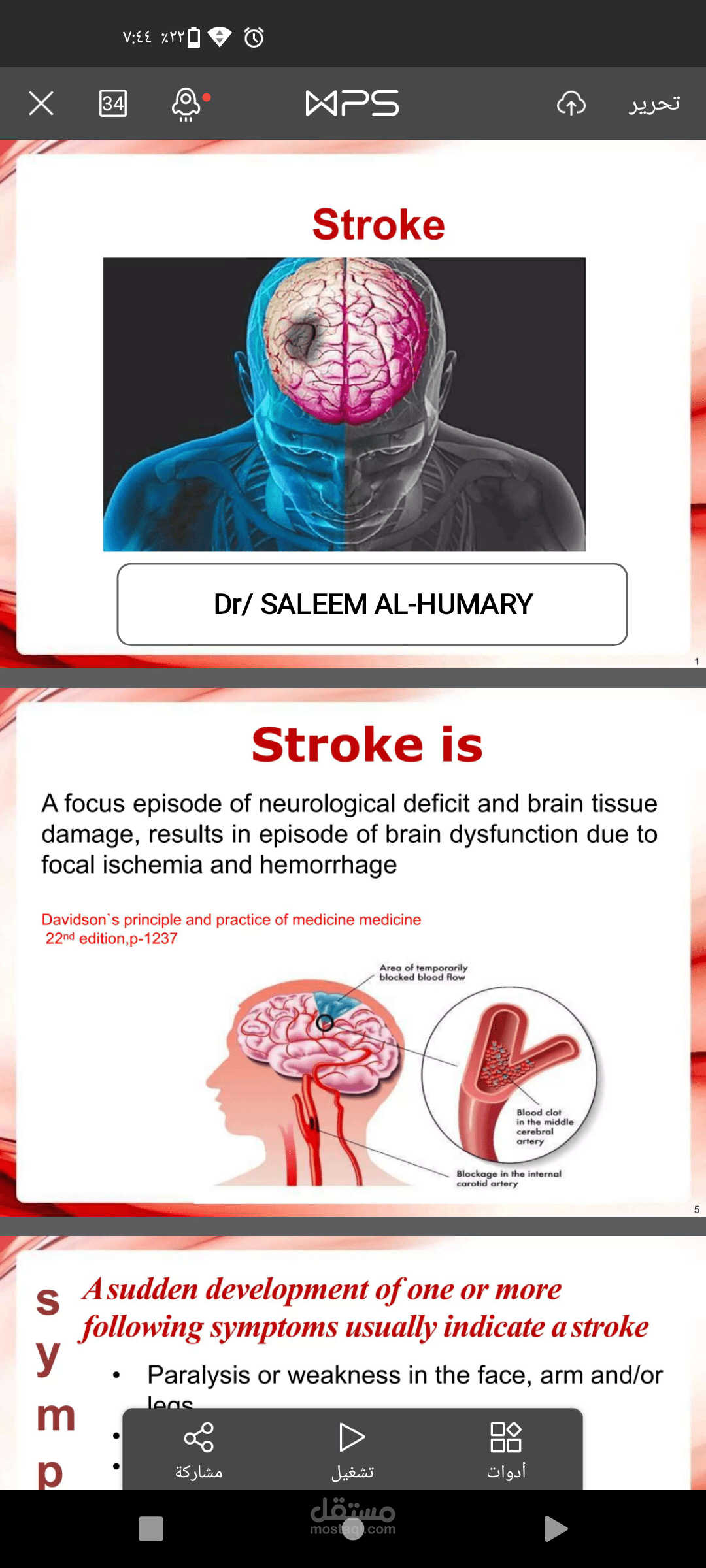 محاظرة بعنوان stroke