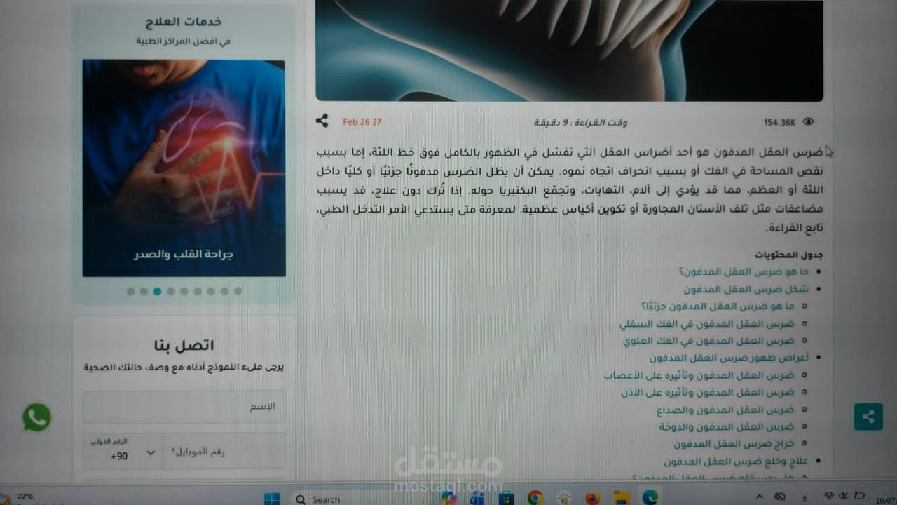 مقال مخاطر ومضاعفات ضرس العقل المدفون وكيف يتم علاجه؟