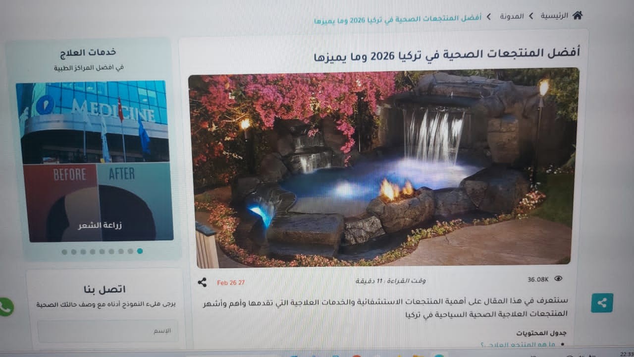 مقال: أفضل المنتجعات الصحية في تركيا ومايميزها