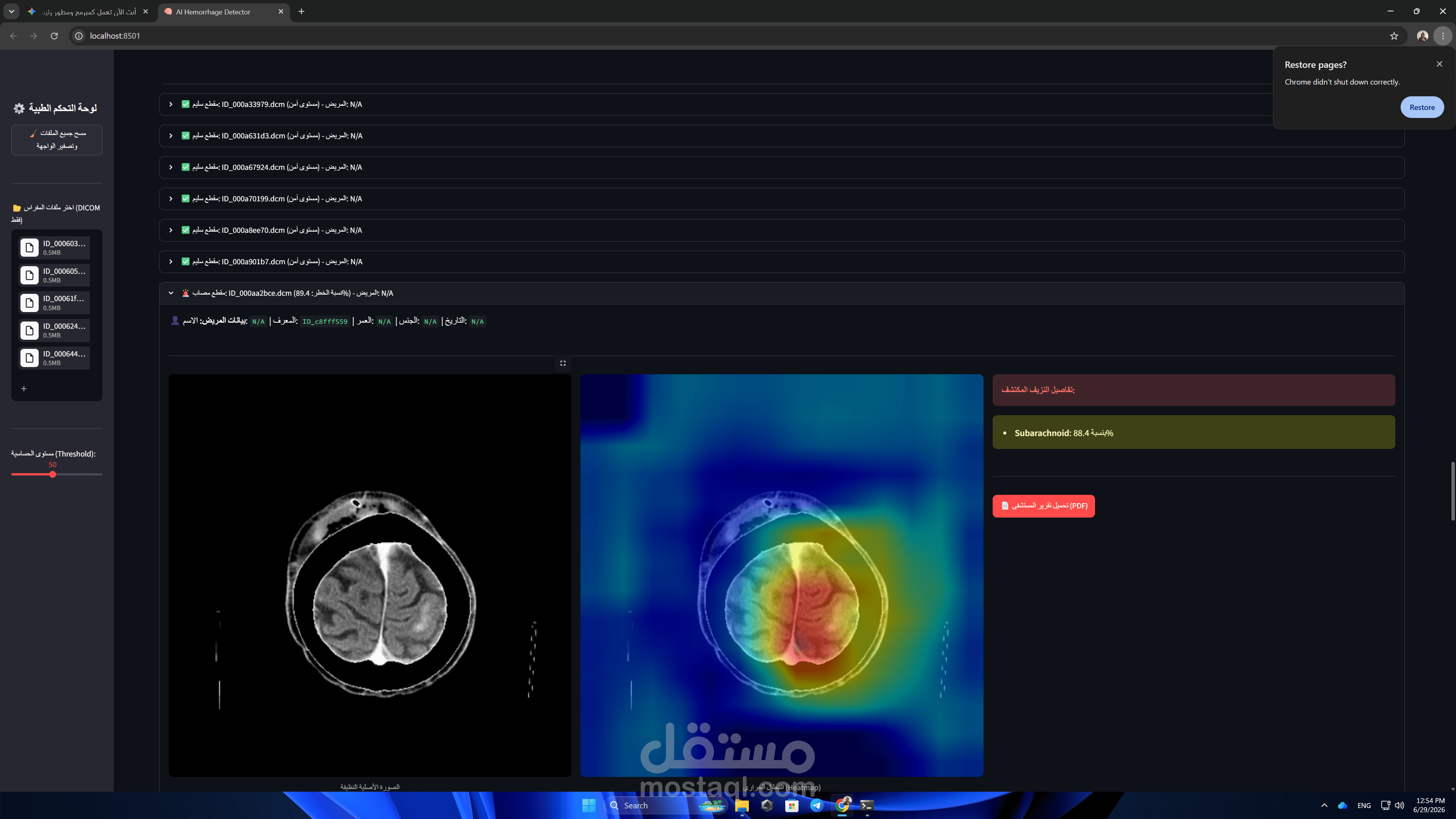 تطوير نظام ذكاء اصطناعي (BrainAI) لتحليل الصور الطبية