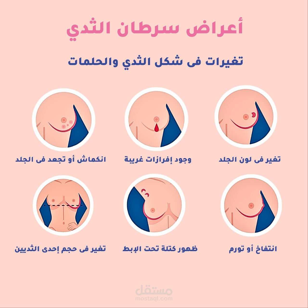 كيف تكتشفين سرطان الثدي مُبَكِّراً؟ دليل شامل للتشخيص وطرق الوقاية