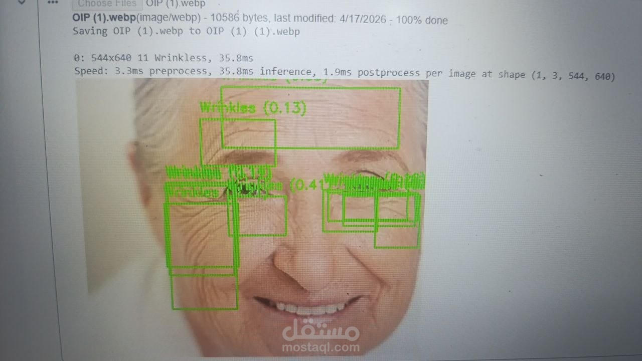 AI-Powered Skin Analysis