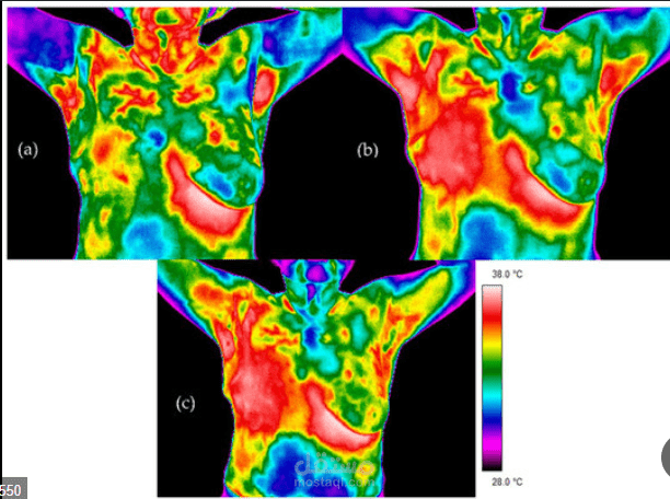 breast cancer detection