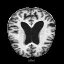 Alzheimer_Classification