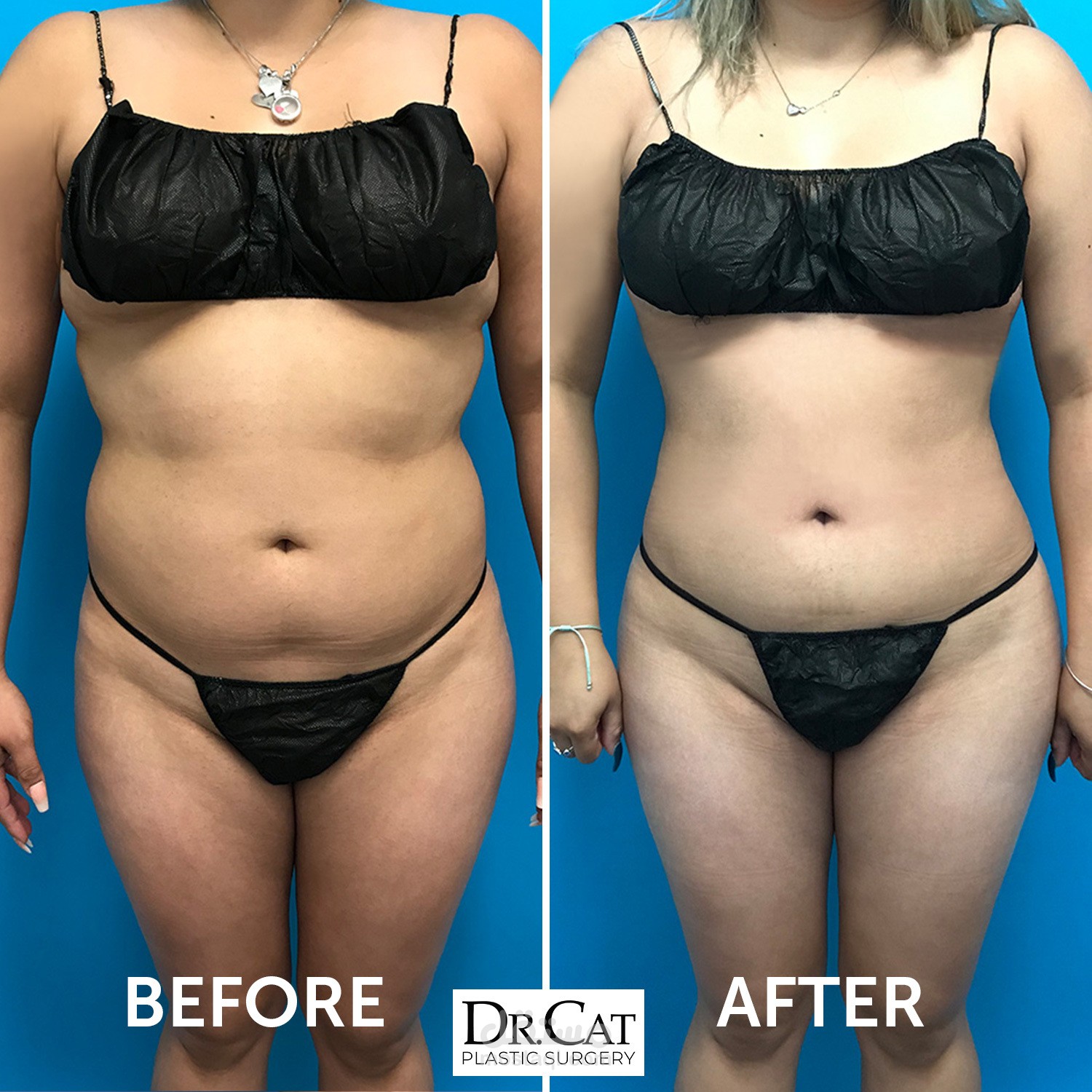 عيادات ميام التجميلية