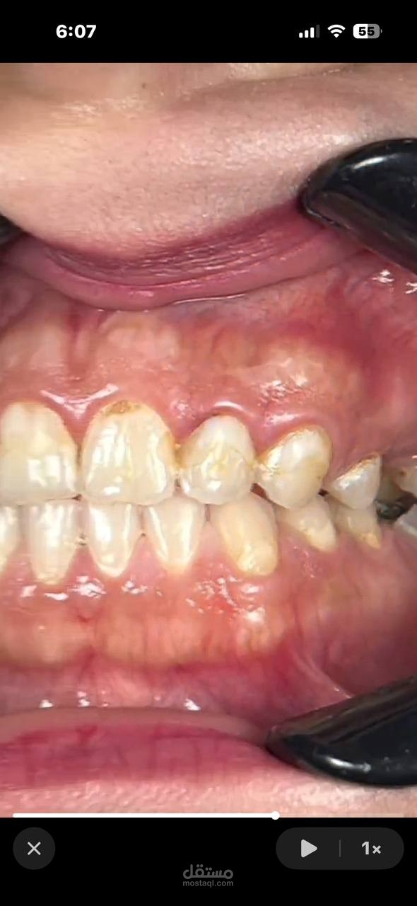 فيديو موشن جرافيك في طب الاسنان