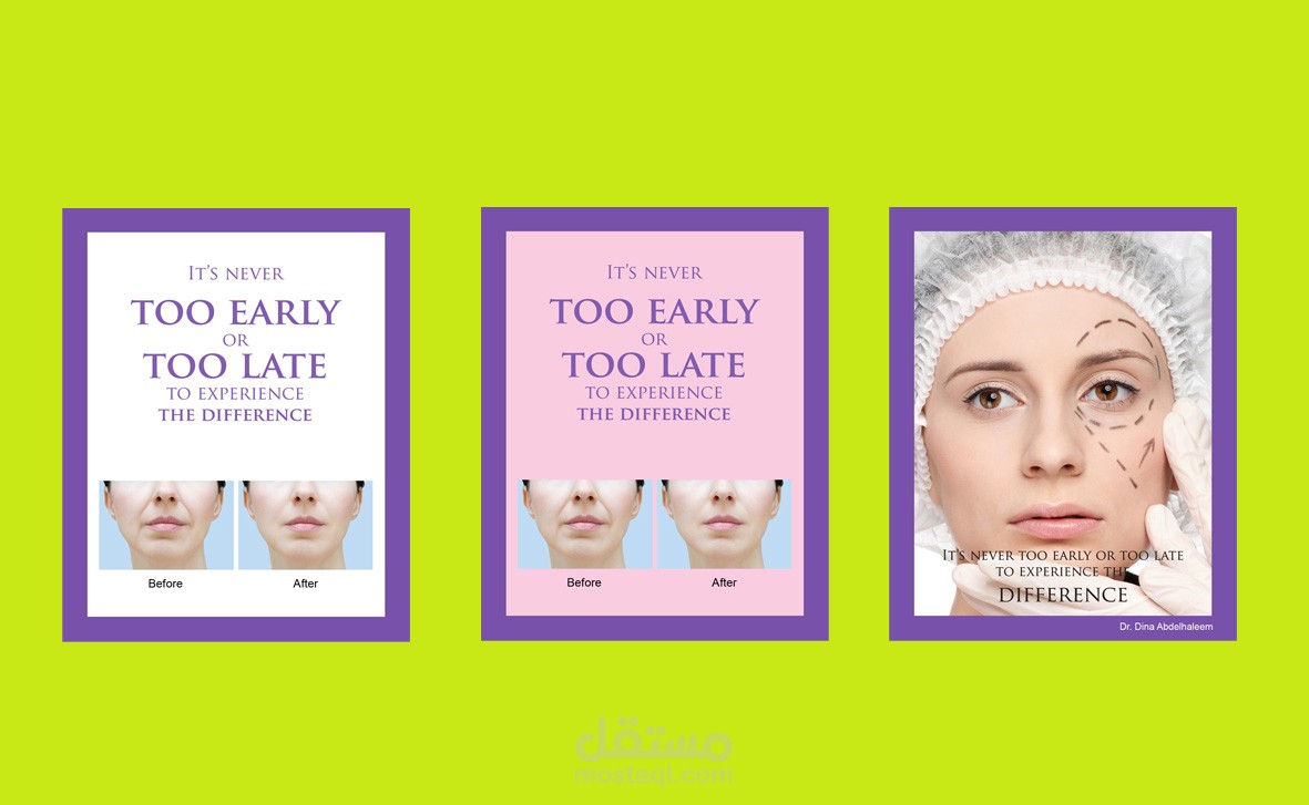 بوستات سوشيال ميديا عيادة تجميل