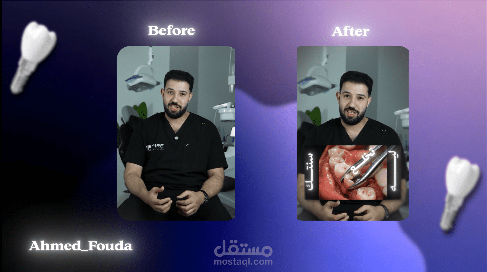 ريل لطبيب اسنان