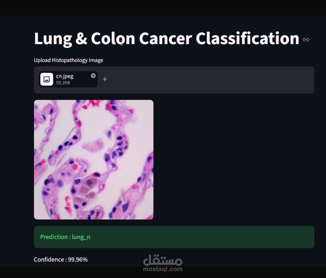 Lung & Colon Cancer Classification using Deep Learning