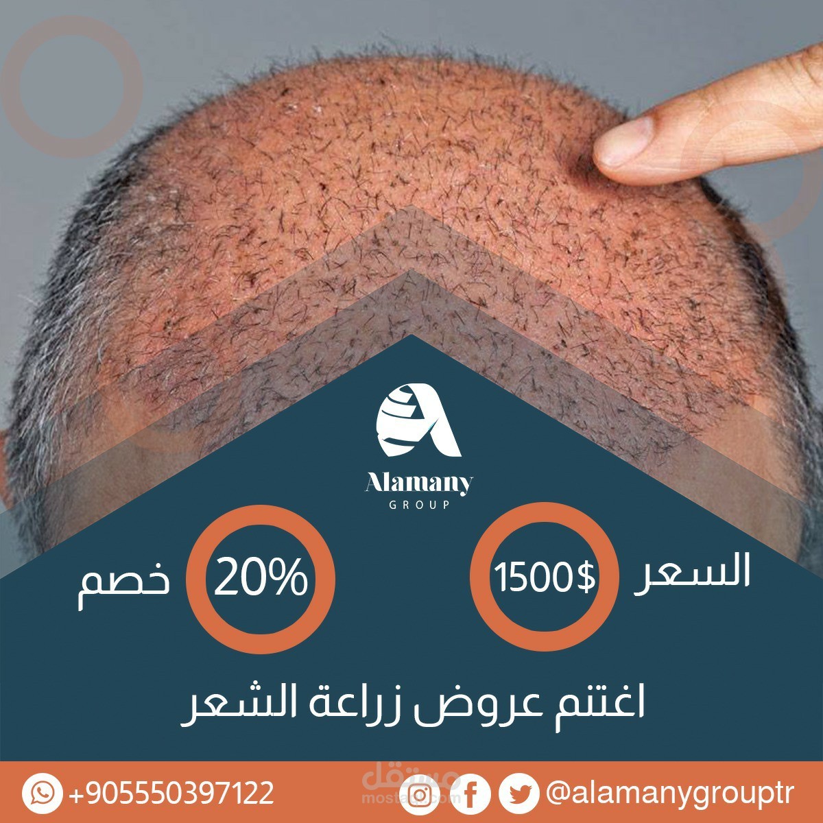 بوستر لمركز زراعة الشعر