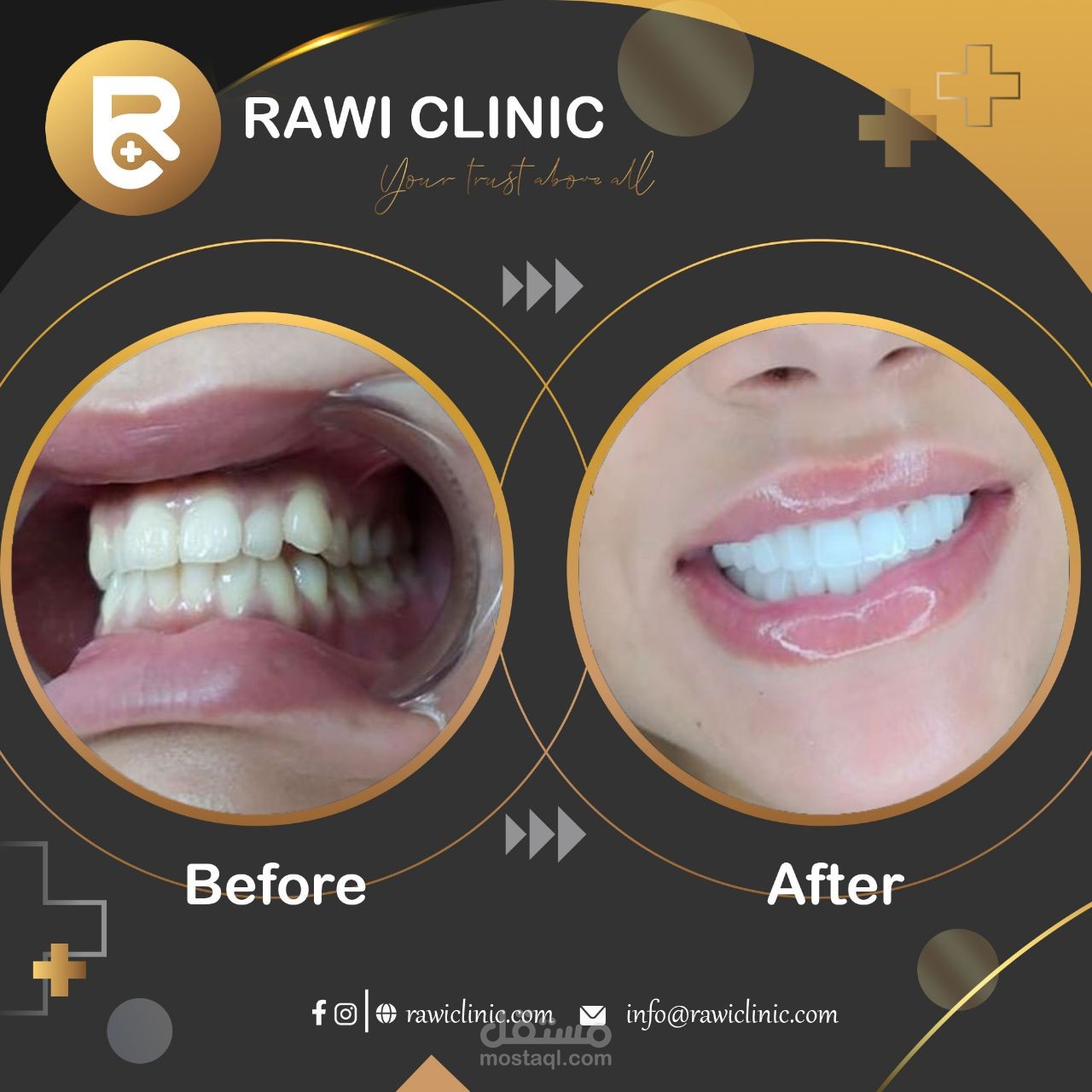 فيديو سلايد شو ريلز ستوري للسناب شات والتيك توك لعيادة الراوي كلينيك