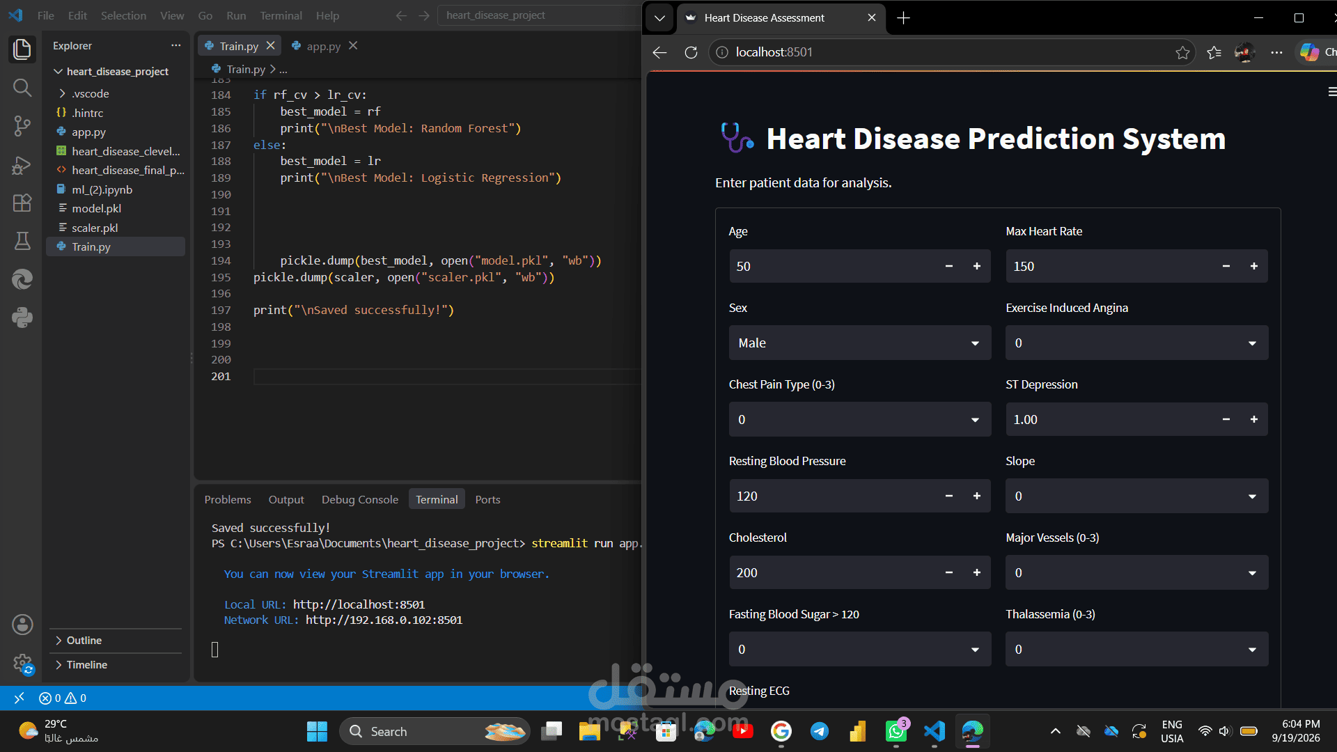 Heart Disease Prediction