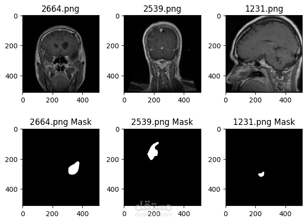 Brain Tumor Segmentation Using U Net