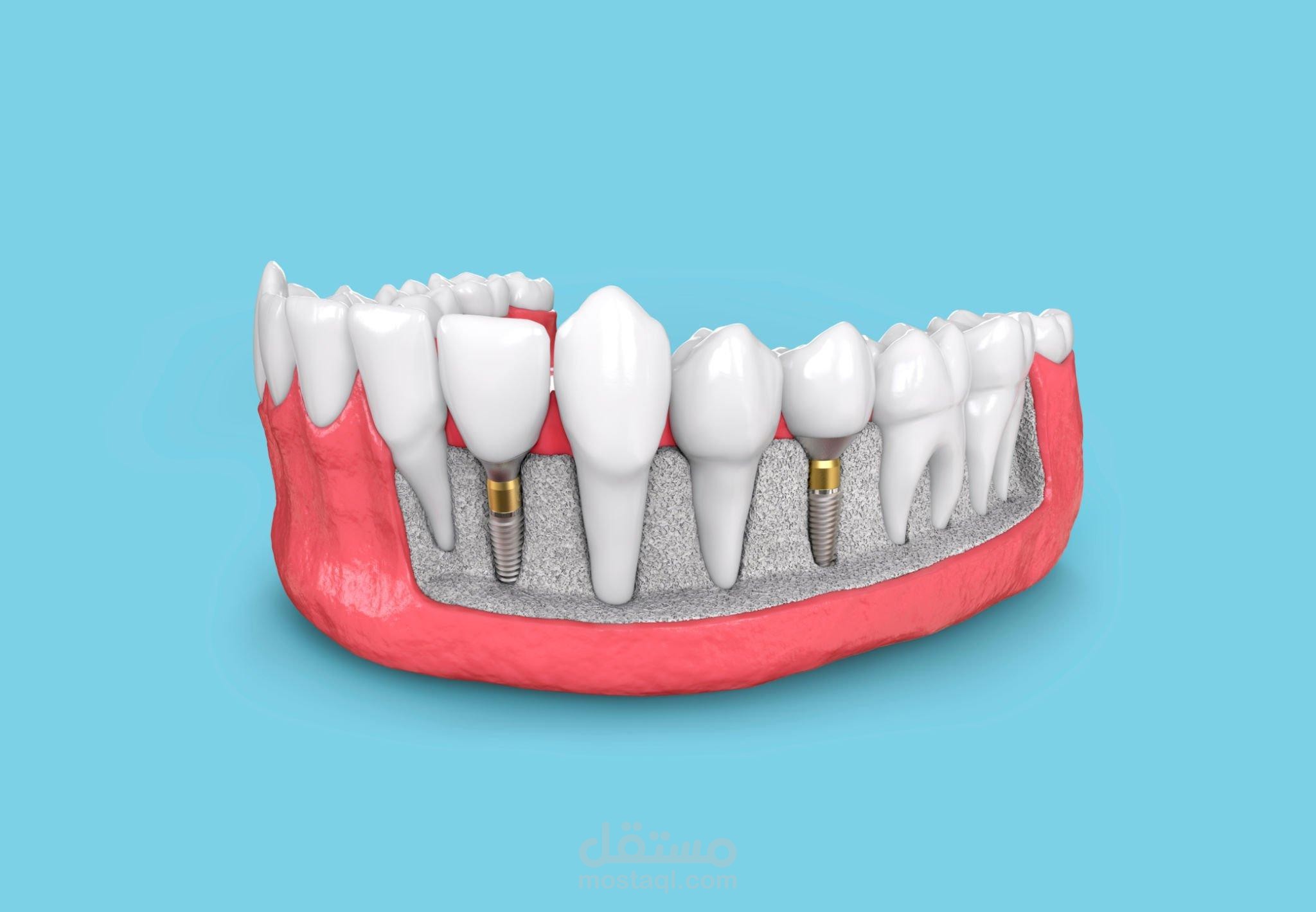 تصميمات سوشيال ميديا (  لمركز اسنان )