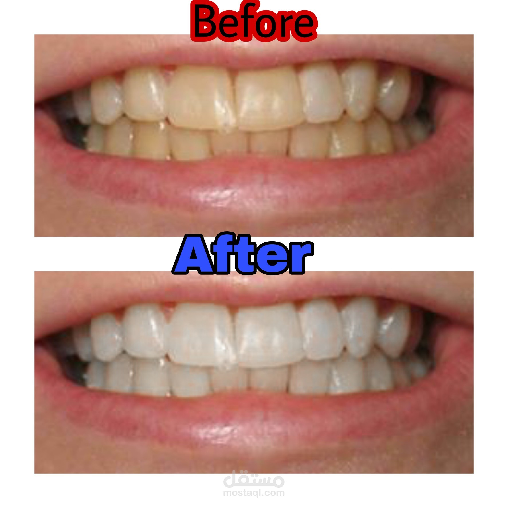 تبييض الاسنان باستخدام الفوتوشوب