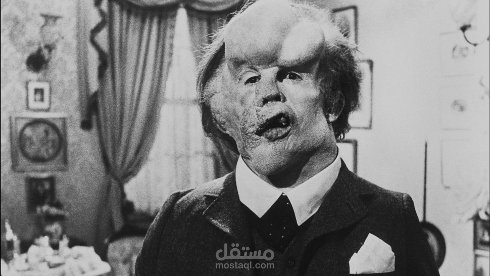 أسطورة الرجل الفيل _سكريبت فيديو يوتيوب طبي