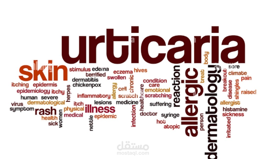 Urticaria