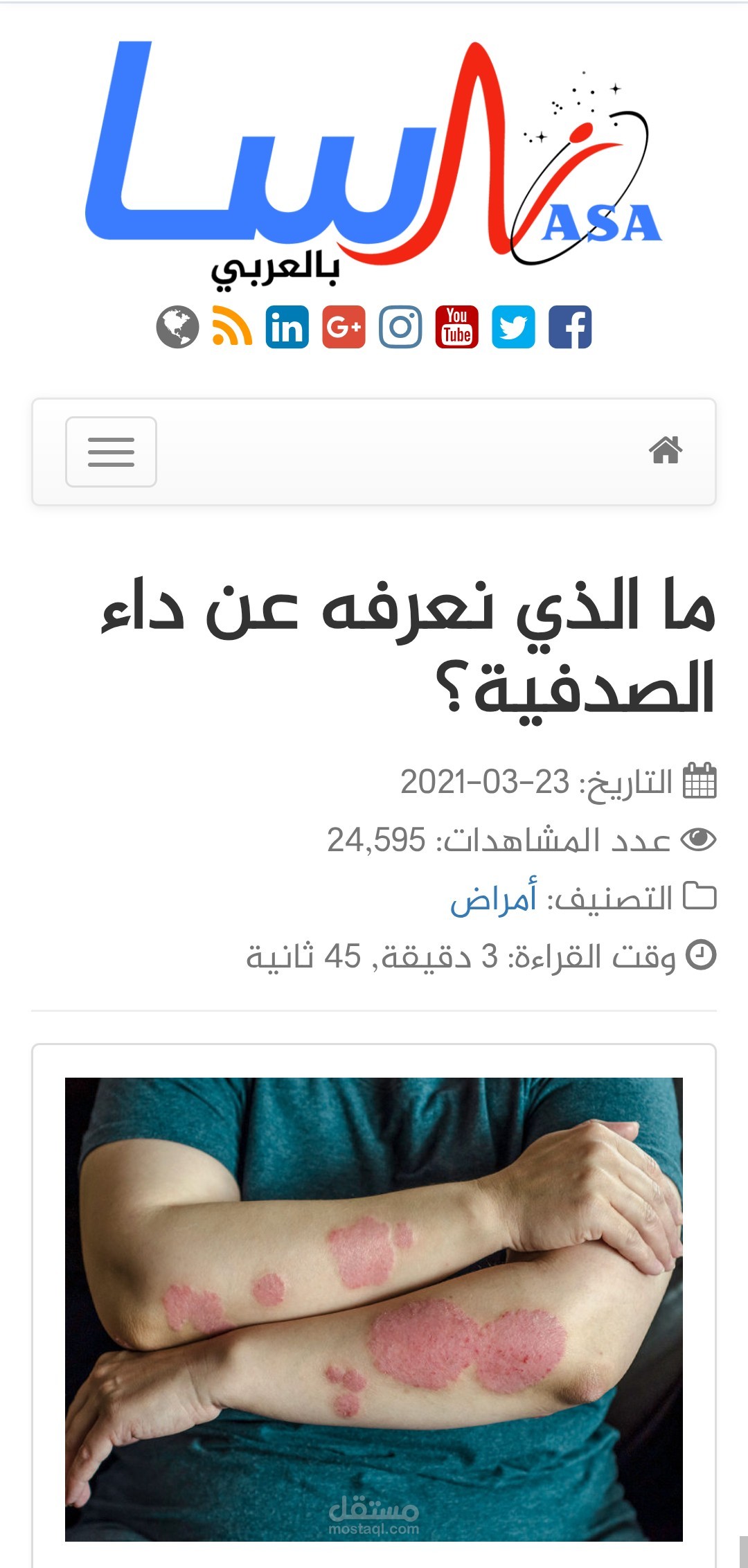 أعلى معدل قراءة من نصيب: ما الذي نعرفه عن داء الصدفية؟