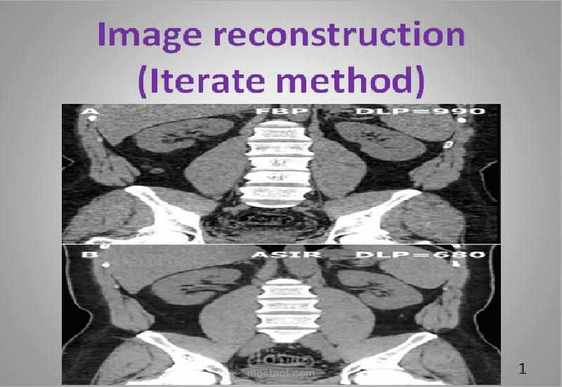عرض تقديمي لبحث علمي تخصص أشعة