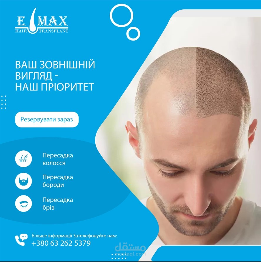 حملات اعلانية موسعة لشركة Emax Hair لزراعة الشعر فى تركيا واوكرانيا على الانستجرام والفيس بوك وتيك توك