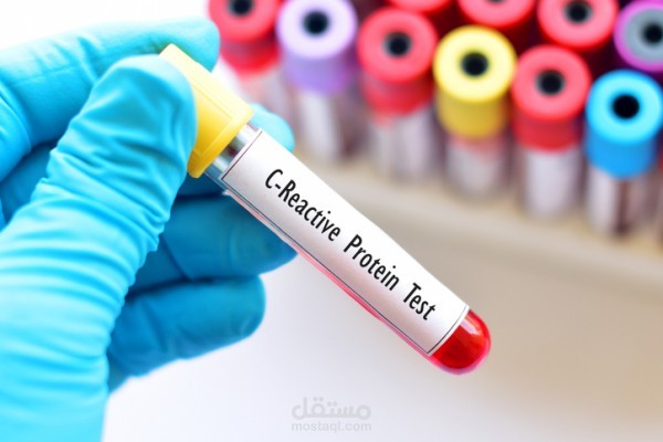 ما هو تحليل CRP