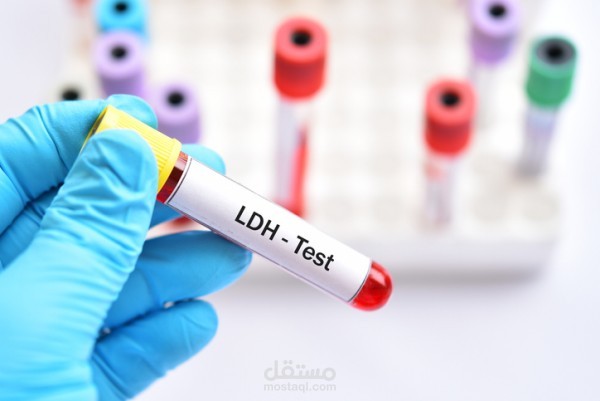 ما هو تحليل LDH