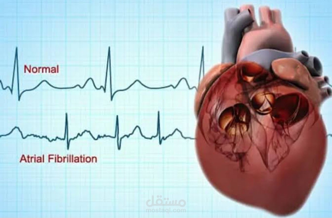 Medical translation Sample (Cardiology)