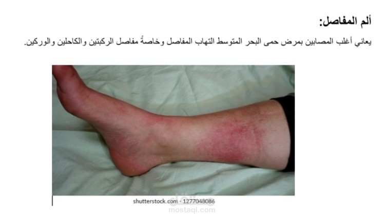 حمى البحر المتوسط
