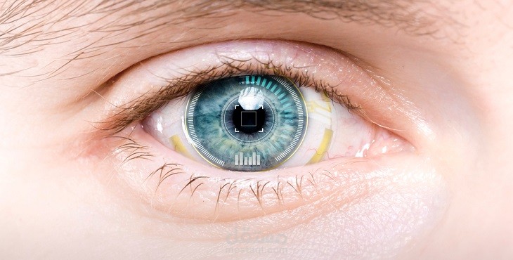 تجربتي مع عملية زراعة العدسات