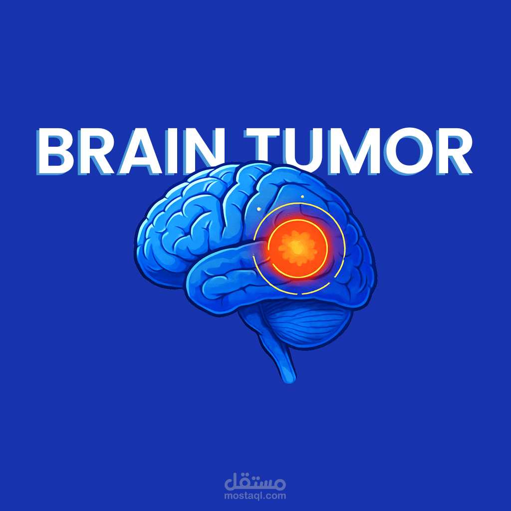 نموذج ذكاء اصطناعي لتحديد موقع أورام الدماغ (Brain Tumor Segmentation)