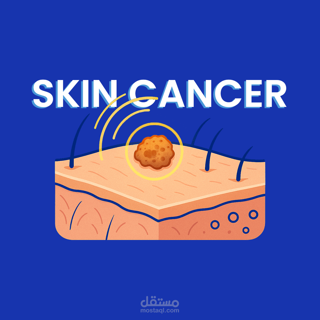 نموذج ذكاء اصطناعي لتشخيص سرطان الجلد (Skin Cancer Classification)