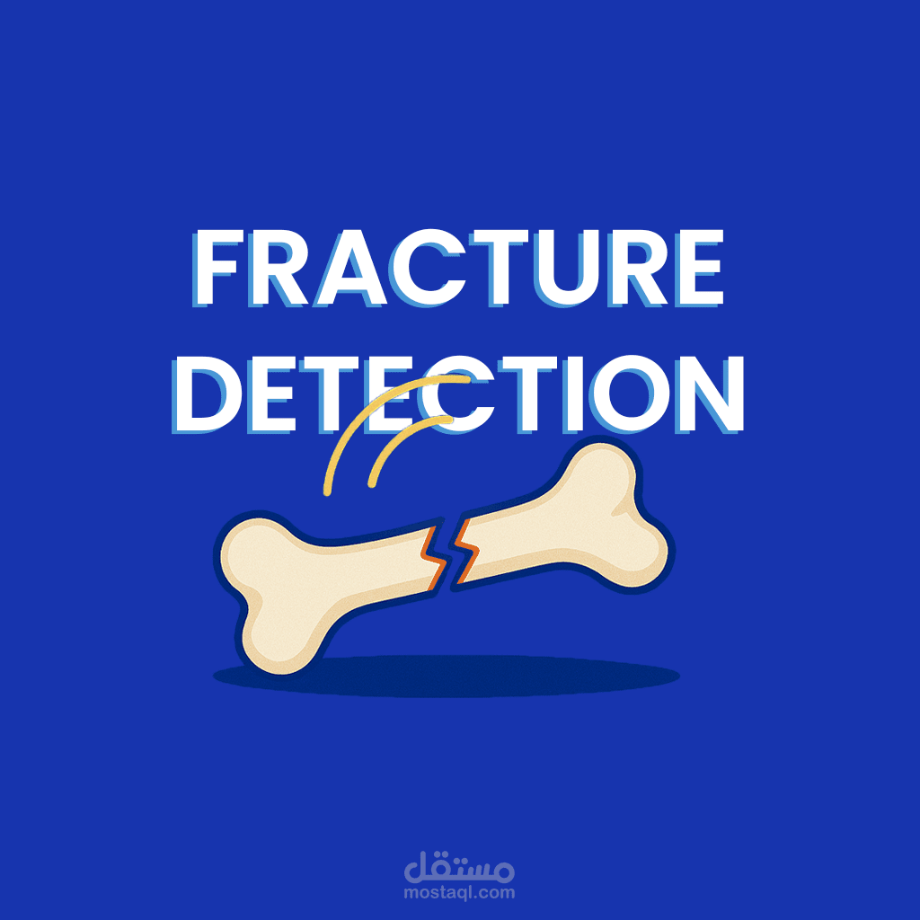 نموذج ذكاء اصطناعي لاكتشاف كسور العظام (X-ray Fracture Detection)