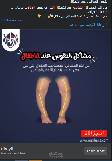 مشاكل التقوس عند الأطفال