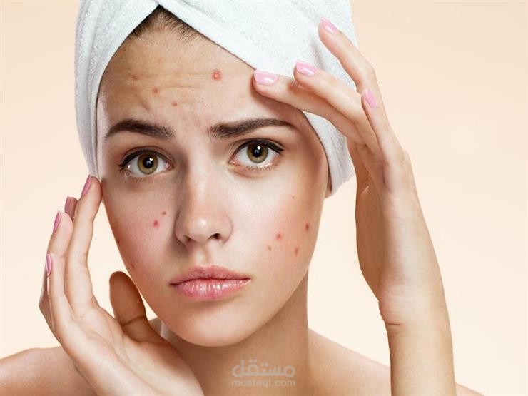 Remove acne ازالة حب الشباب من الوجه