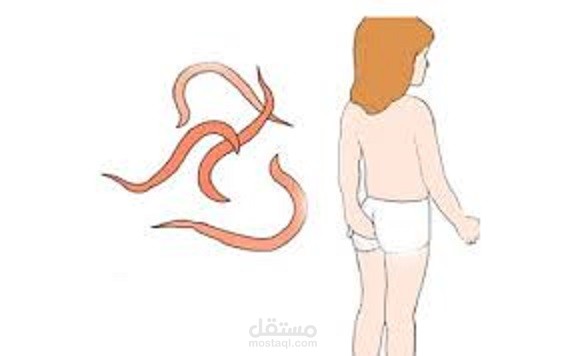 علاج الديدان عند الأطفال