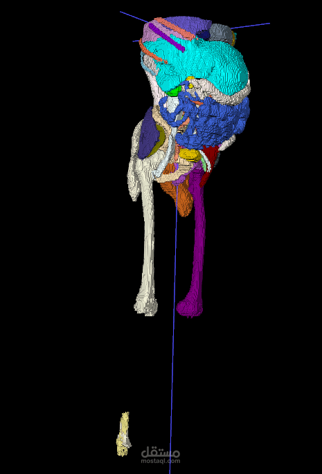 automated surgery planning measurements system