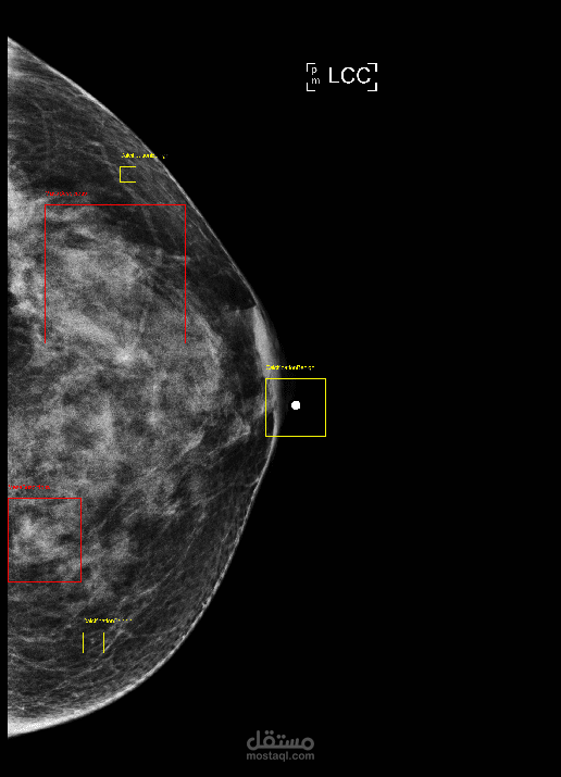 Breast Mammo Scanner