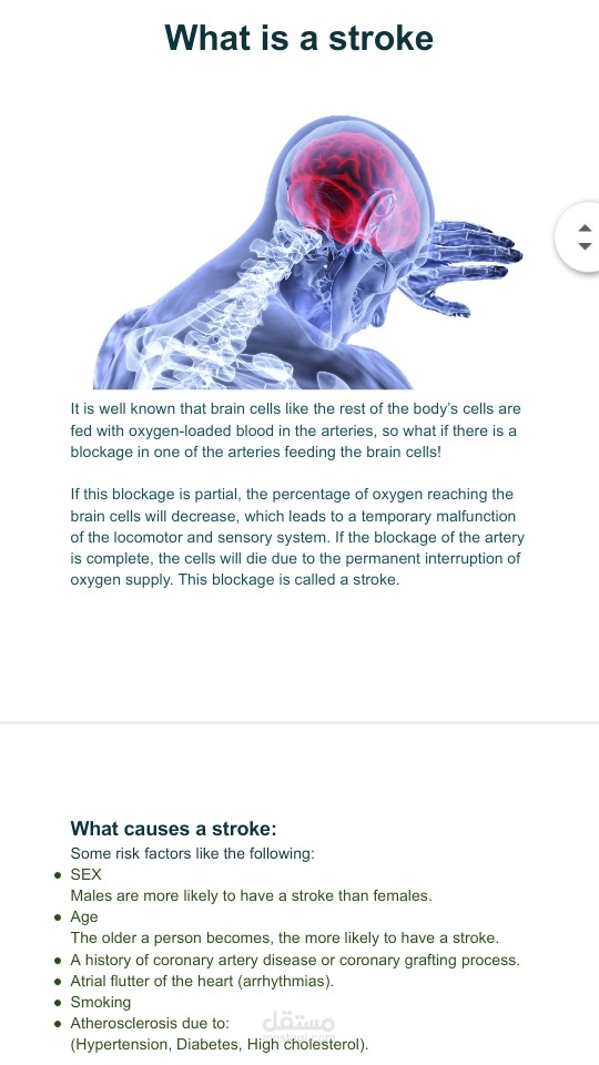 Medical article about Stroke with applied SEO activities