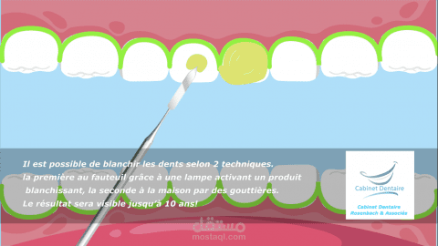 Motion graphic shows how to whiten teeth