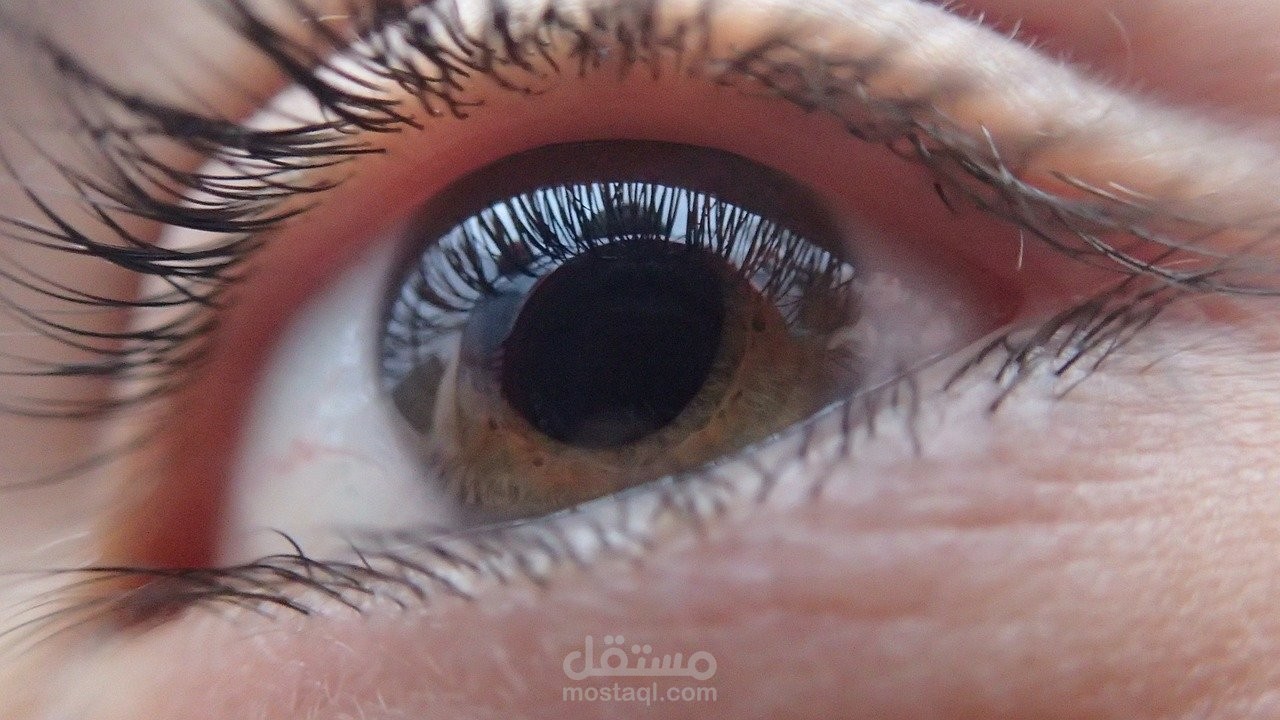 أفضل 15 قطرة لعلاج جفاف العين