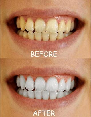 تعديل على الصور