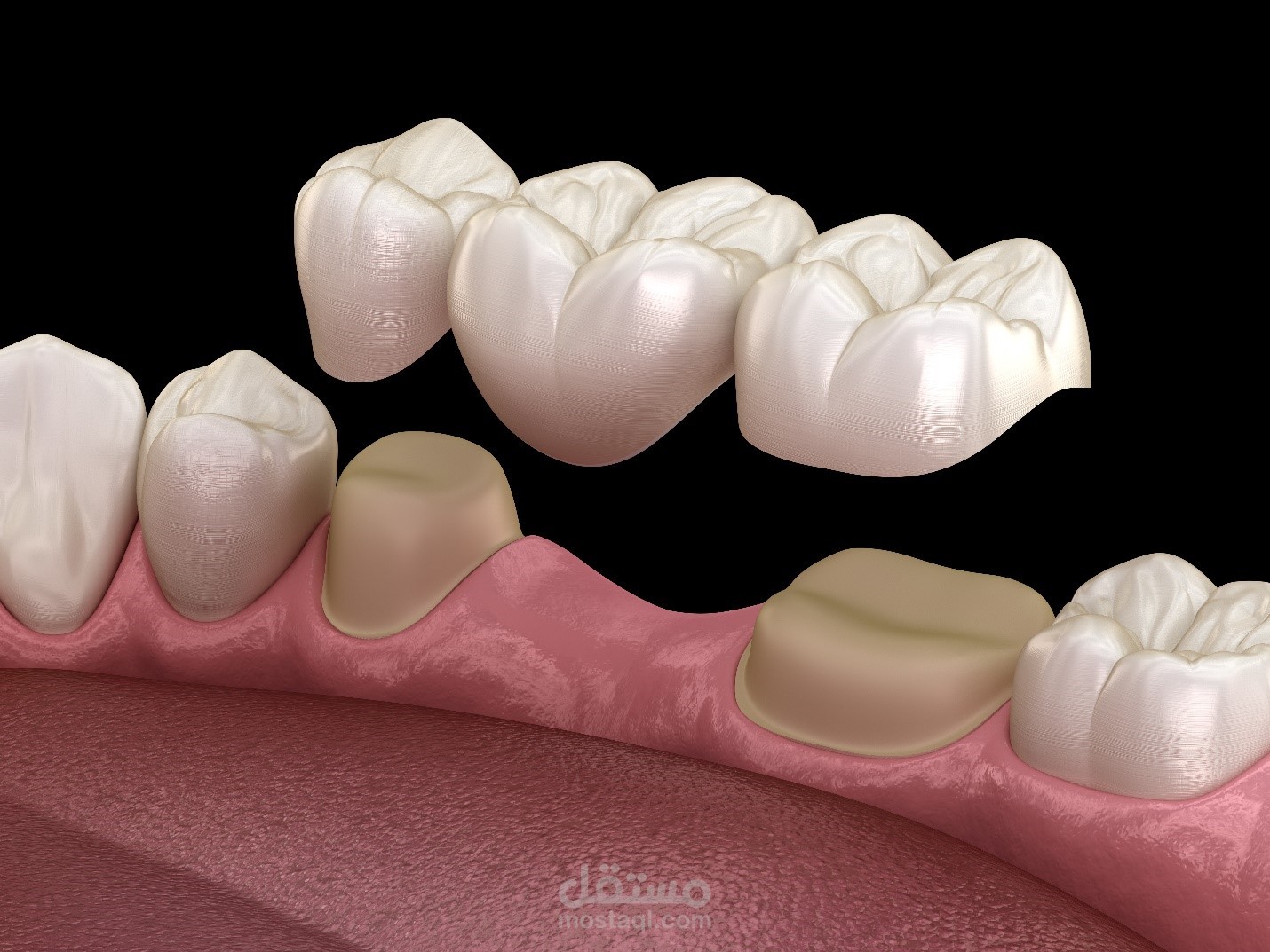 بحث مصغر عن التركيبات الثابته