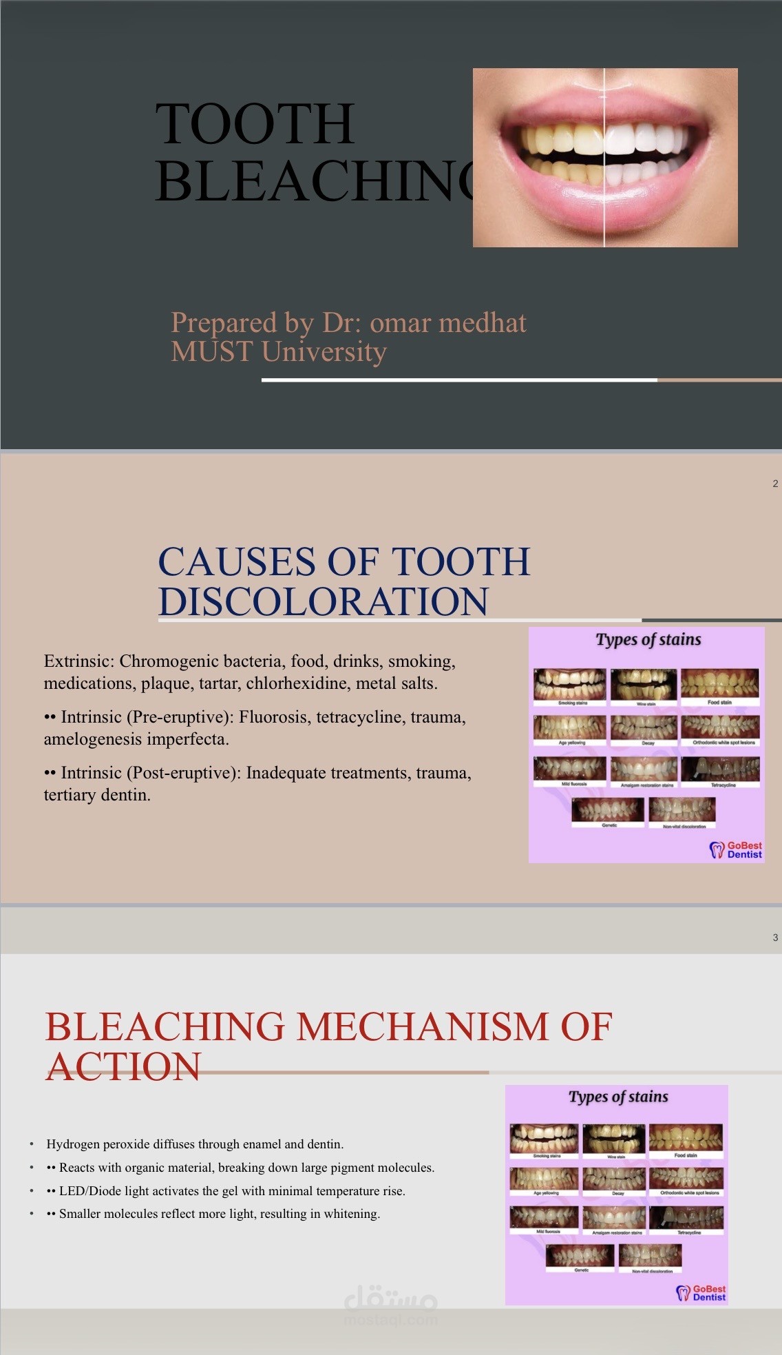 Laser bleaching
