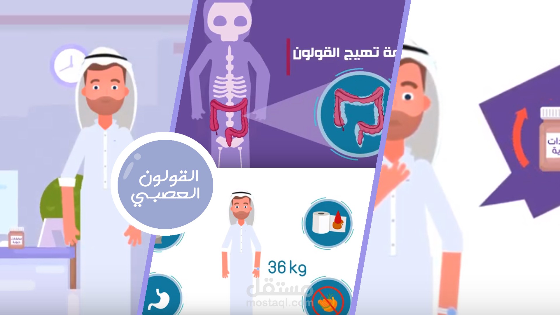 القولون العصبي