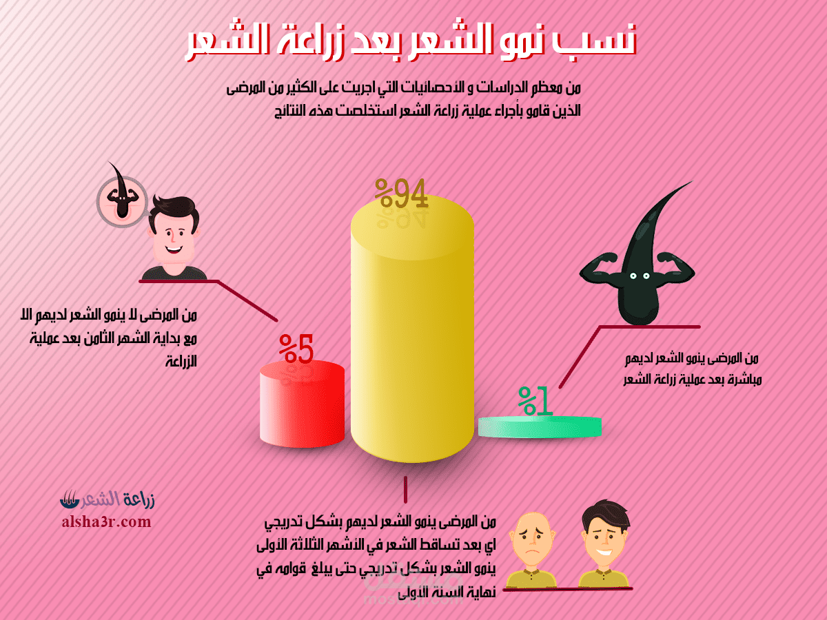 نسب نمو الشعر بعد زراعته