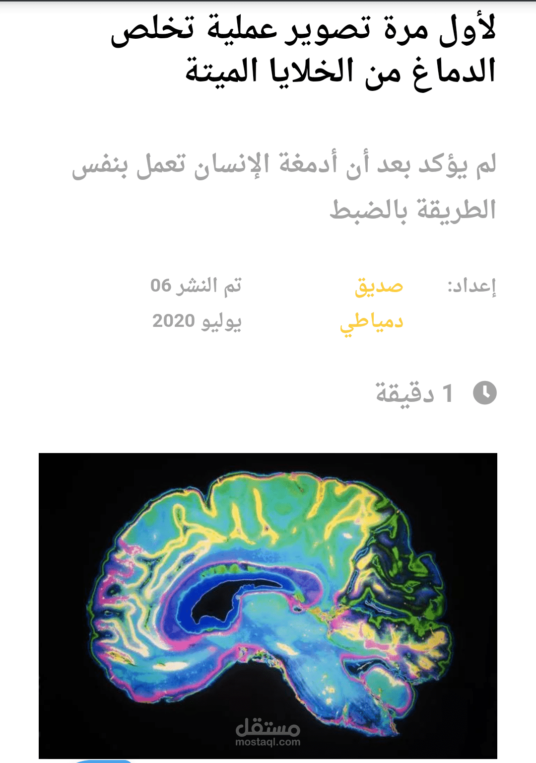 لأول مرة تصوير عملية تخلص الدماغ من الخلايا الميتة