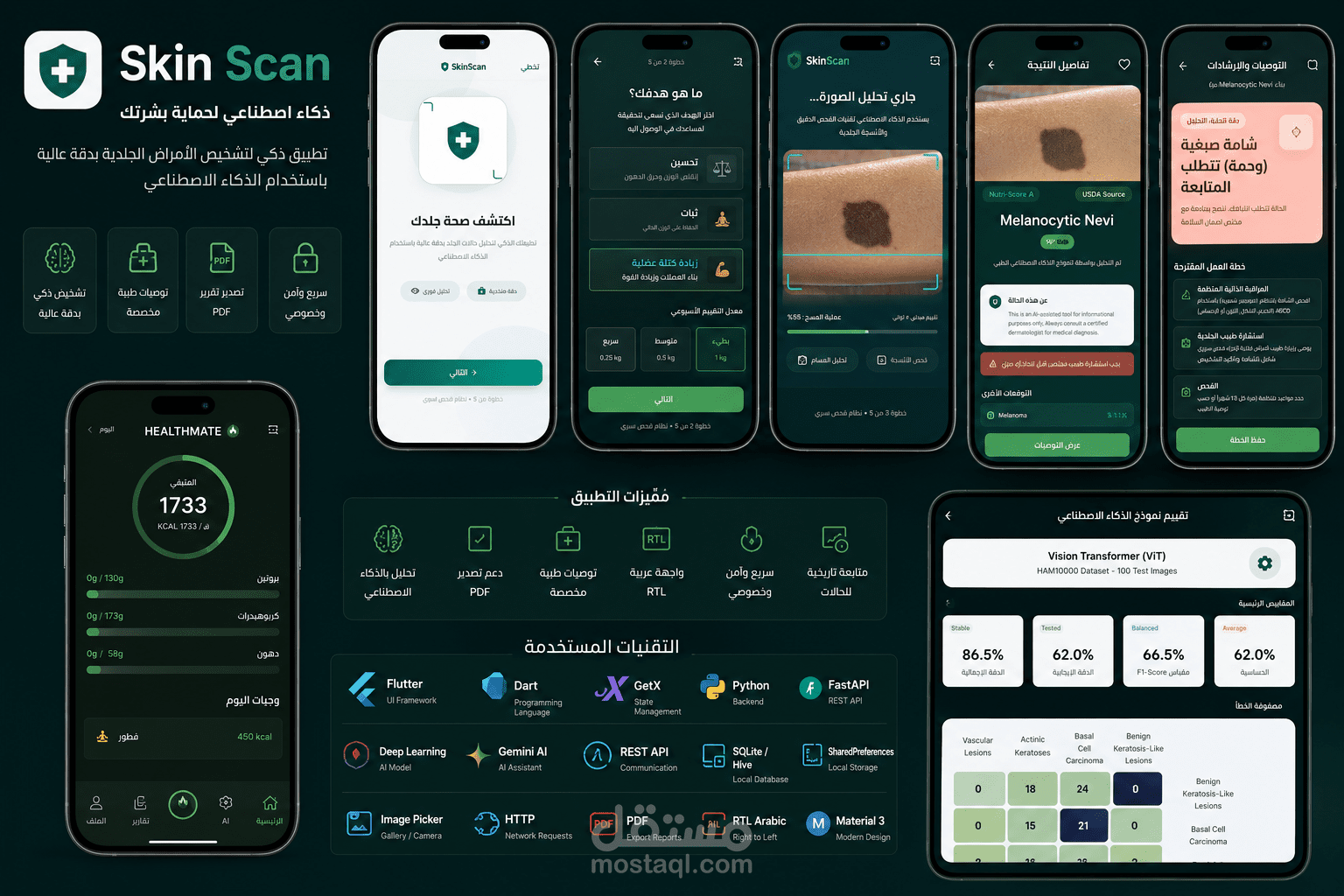 Skin Scan — AI-Powered Skin Disease Diagnosis