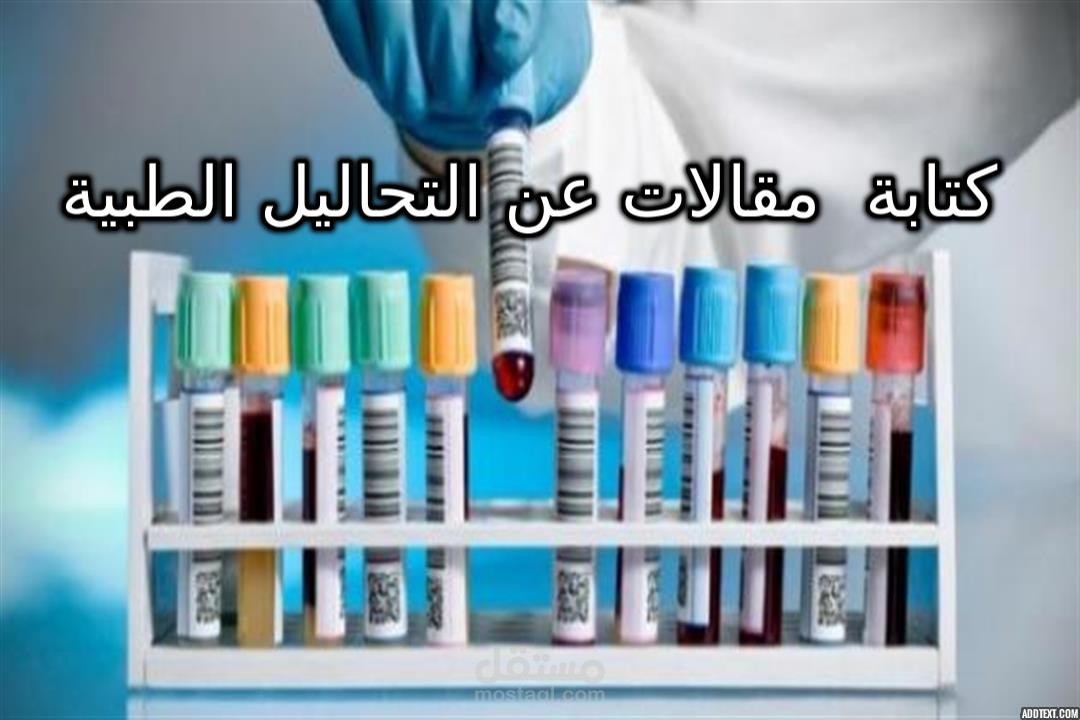 كتابة مقالات عن التحاليل الطبية