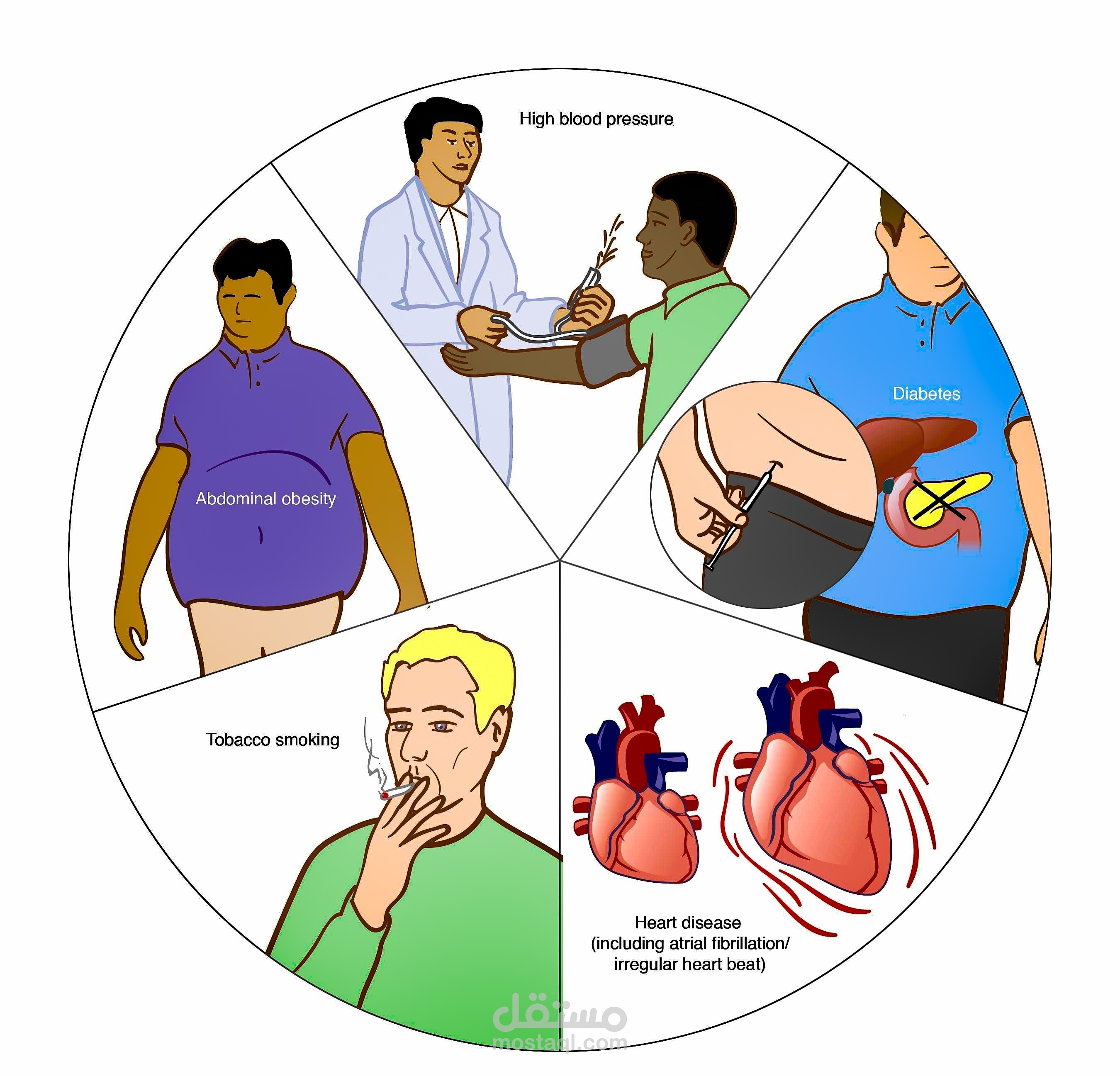 كتابة مقال طبي عن السكتة الدماغية